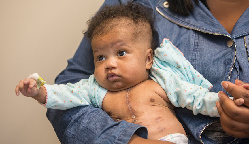 A heart transplant recipient is seen in Le Bonheur's cardiology clinic.